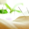 akupunkturoa ThinkstockPhotos-873028342.jpg