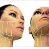 Ulthera-Facial-Thermal-Coagulation-Points-1-002.jpg