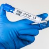 koronavirus pm.jpg