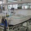 sbms, intentivno-zdravljenje, covid, bolniki, medicinski-ventilator