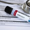 koronavirus, test