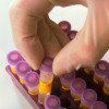hepatitis c, hepatitis b, testiranje