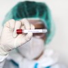 koronavirus, covid-19, covid19, testiranje, okužbe, razkužilo