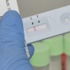 murska-sobota, oddelek-za-laboratorijsko-diagnostiko, splošna-bolnica-murska-sobota