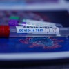 covid, test, koronavirus, laboratorij