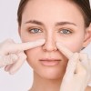 rinoplastika, operacija-nosu, nos