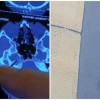 krogla, glava, mri