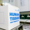 hujman tissue Profimedia.jpg