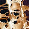 250-KOST-osteoporoza.jpg