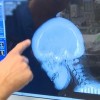 skull-surgery-simbolična.jpg