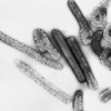 Marburg_virus.jpg