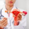Endometrioza.jpg