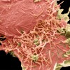 Humani metapnevmovirus.jpg