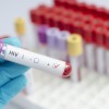 1481559901_cg-hiv.jpg