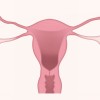 1731939210_uterus-3777765_1280.jpg