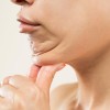 liposukcija vodilna shutterstock.jpg