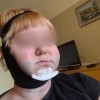 liposukcija2a.jpg