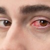 adenovirus.jpg