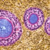 OvarianFollicles.jpg