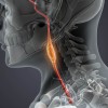 tumor4.jpg
