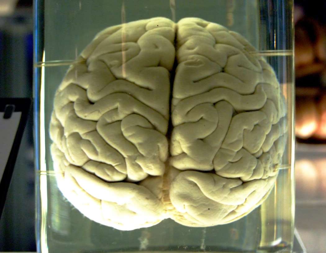 možgani