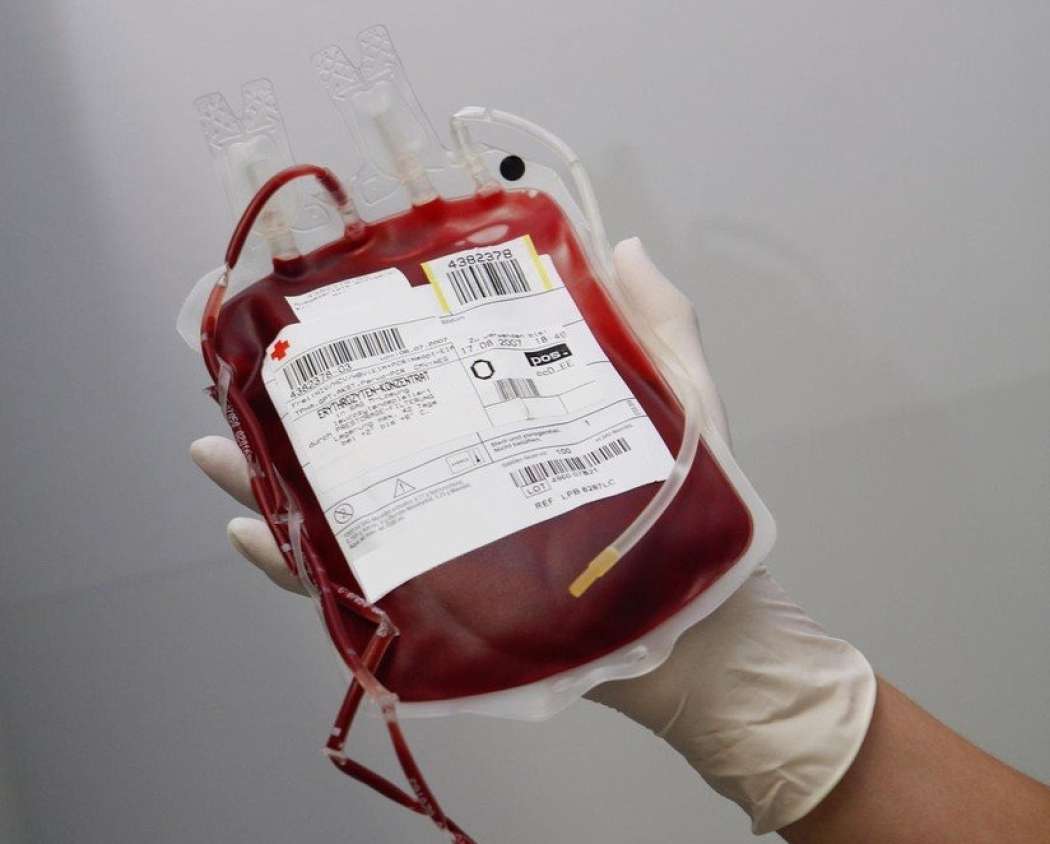 krvna skupina kri vrecka s krvjo