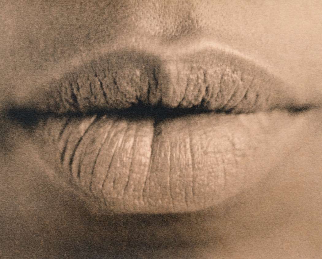 Ustnice