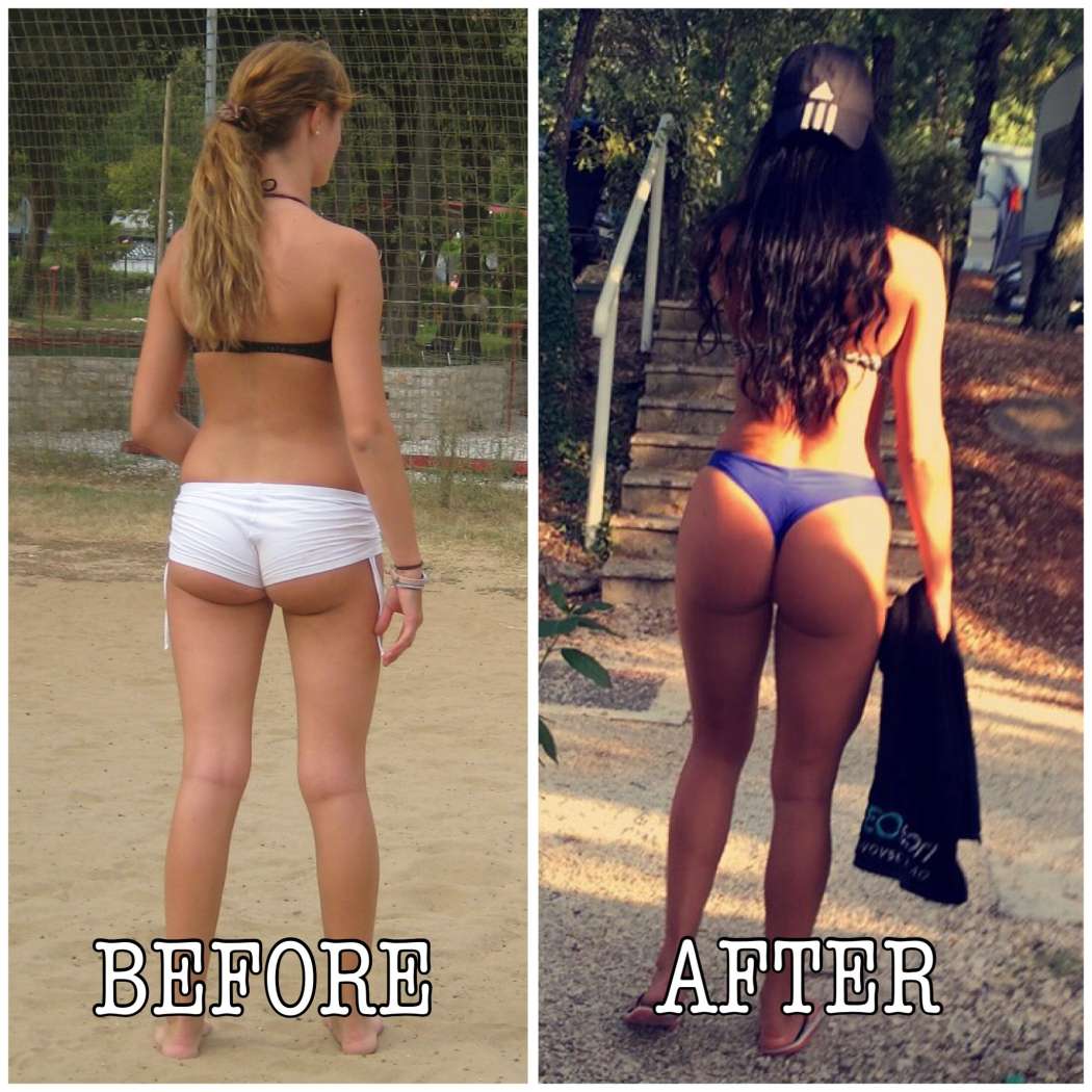 before-after-patricia