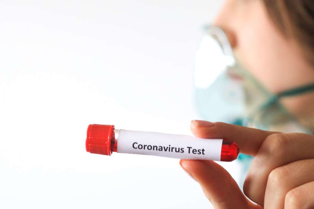 koronavirus, simbol, bris, test