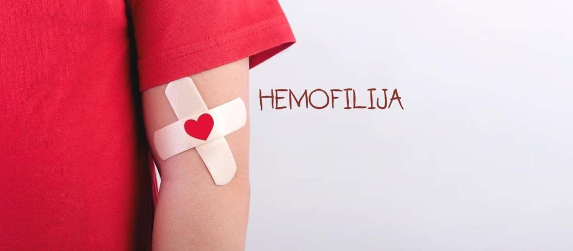 INTERVJU: 'Hemofiliki so premalo prestrašeni  in ne pretirano bojazljivi'