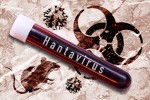 hantavirus.jpg