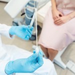 ginekolog, zdravnik, bris, spolno prenosljive bolezni