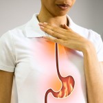 refluks, zgaga, gerb