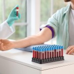 krvna skupina, odvzem krvi