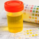 Analiza urina, vzorec, test