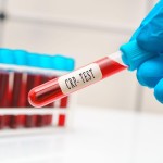 crp test