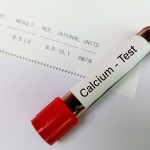 kalcij test