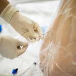 epiduralna, spinalna