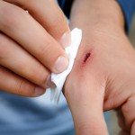 rana, tetanus, čiščenje rane