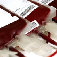 transfuzija