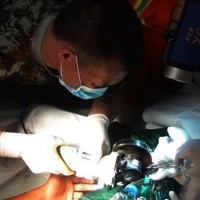 Lian Tien operacija penis ujet