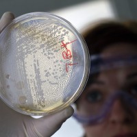 bakterija e.coli antibiotik