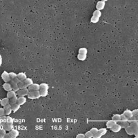 Acinetobacter baumannii bakterija