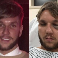 Jack-Wheats-injuries-after-playing-for-Goole-AFC-main