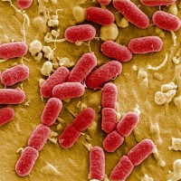 Tako izgleda bakterija e.coli pod mikroskopom