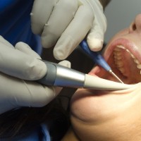 zobar, zobozdravstvene storitve