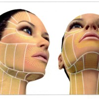 Ulthera-Facial-Thermal-Coagulation-Points-1-002