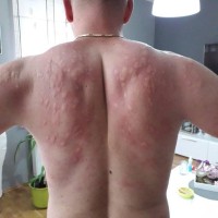 Ivan Zgrebec, komarji, pik komarja