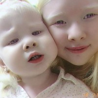 albino-sestri