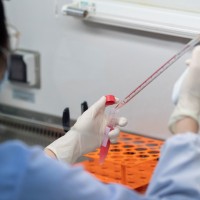 koronavirus, znanstvenik,test, raziskava, laboratorij